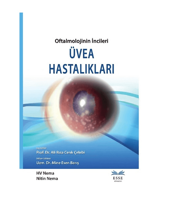 Oftalmolojinin İncileri Üvea Hastalıkları