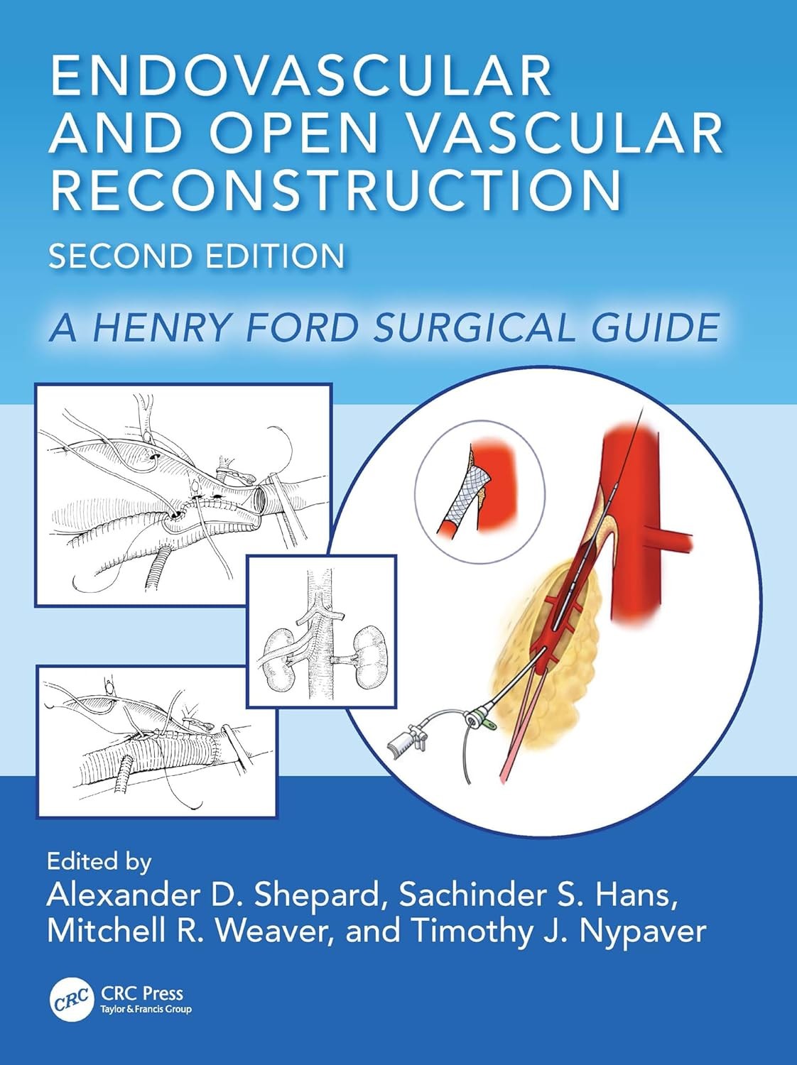 Endovascular and Open Vascular Reconstruction A Henry Ford Surgical Guide,2nd Edition