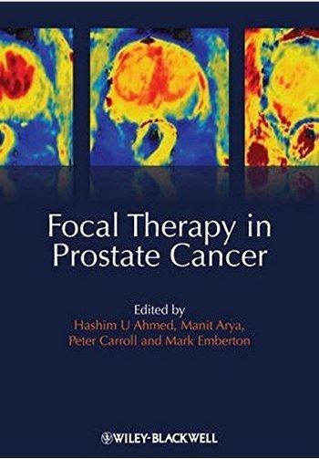 Focal Therapy in Prostate Cancer 1st Edition