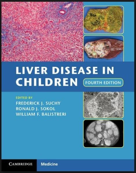 Liver Disease in Children