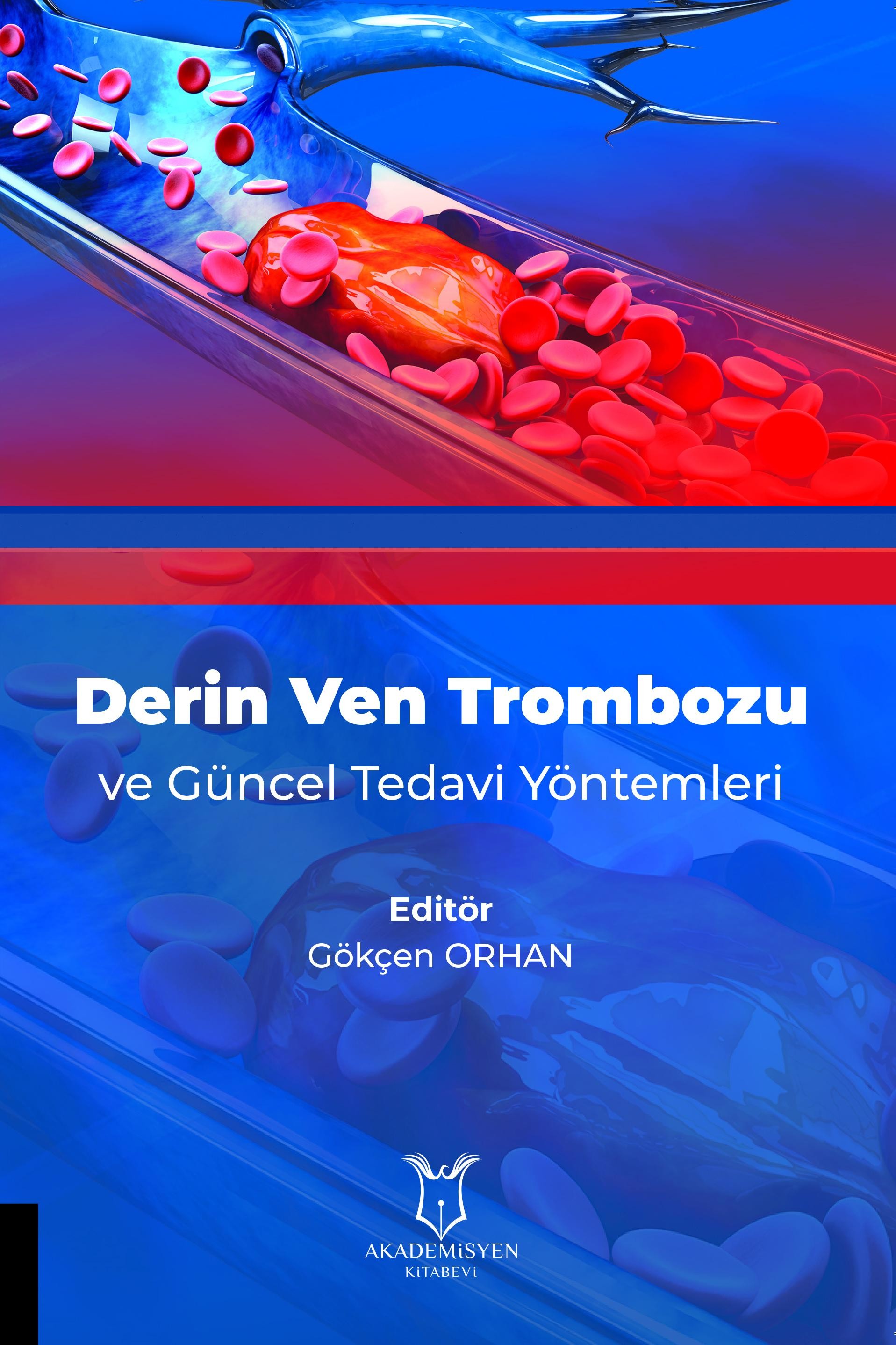 Derin Ven Trombozu ve Güncel Tedavi Yöntemleri