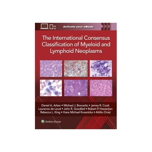 The International Consensus Classification of Myeloid and Lymphoid Neoplasms