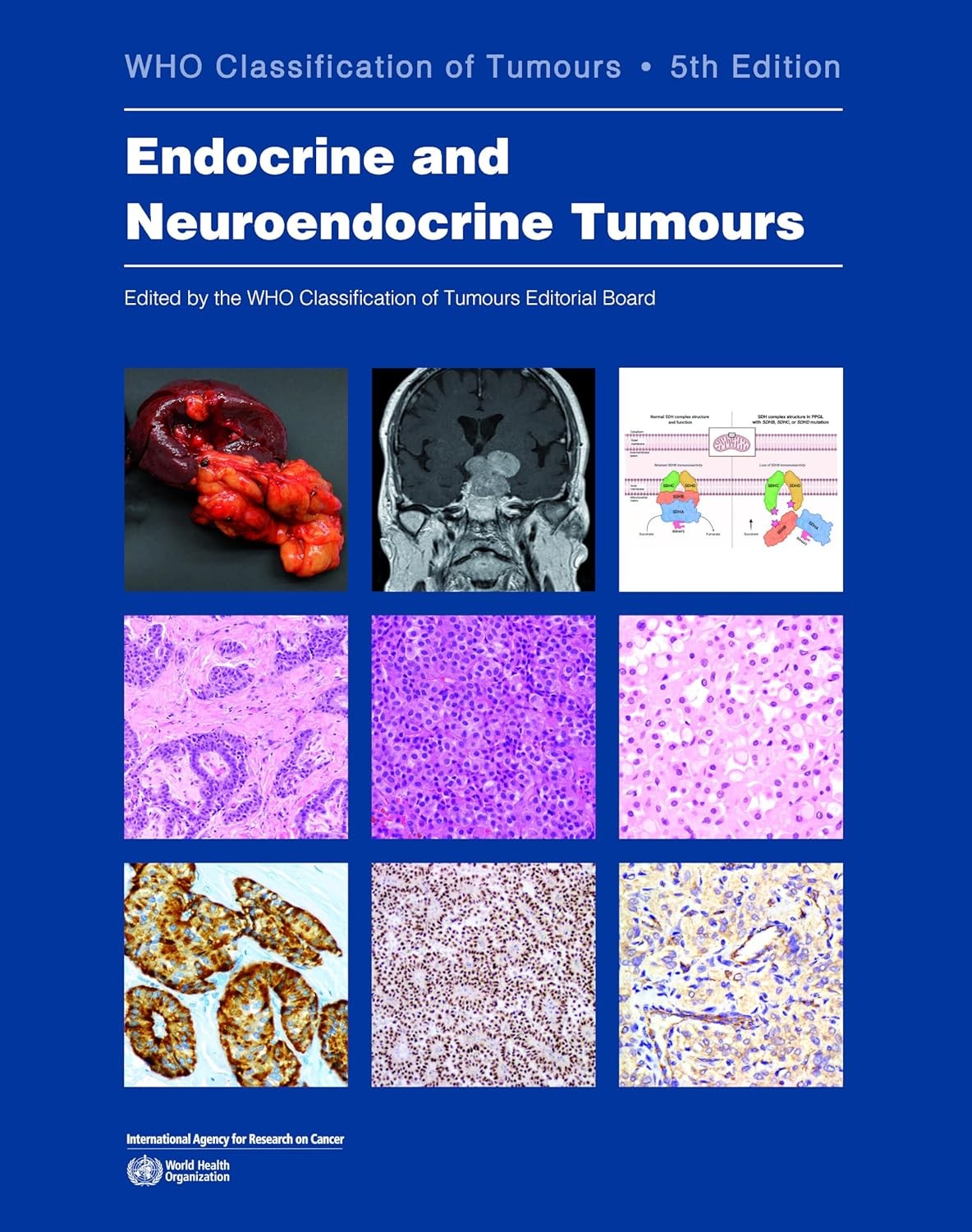 Endocrine and Neuroendocrine Tumours WHO Classification of Tumours, 5th