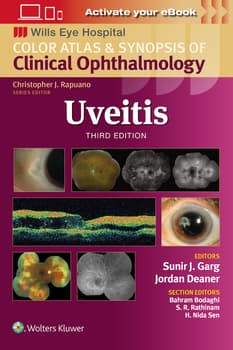 Uveitis,3 Edition