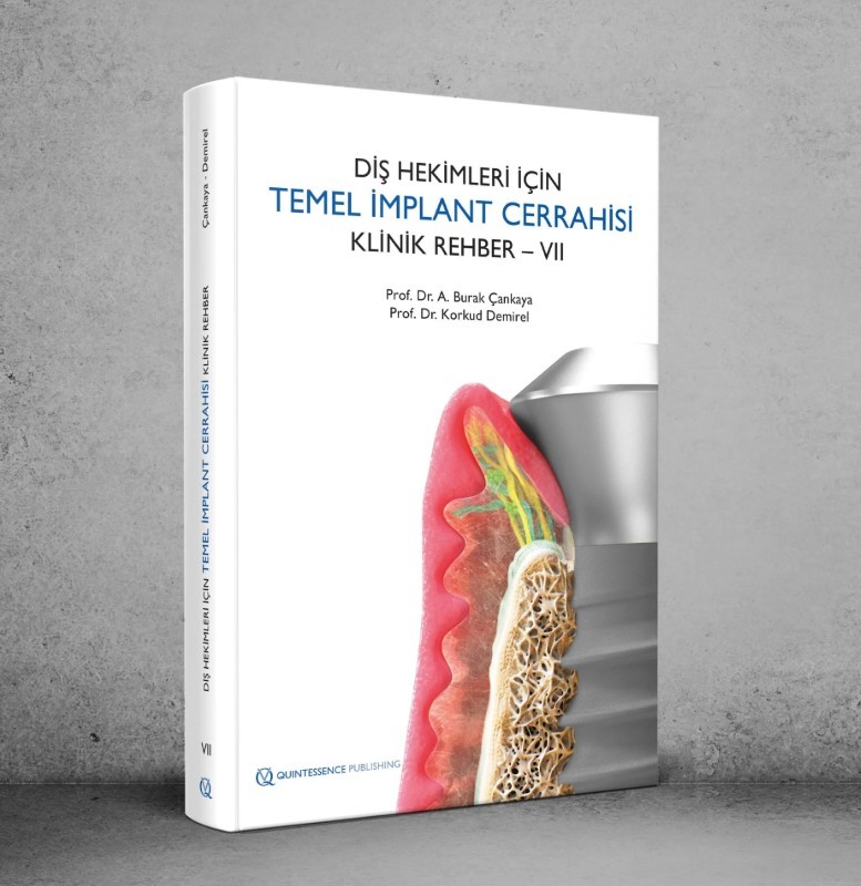 Diş Hekimleri İçin Temel İmplant Cerrahisi Klinik Rehber – VII