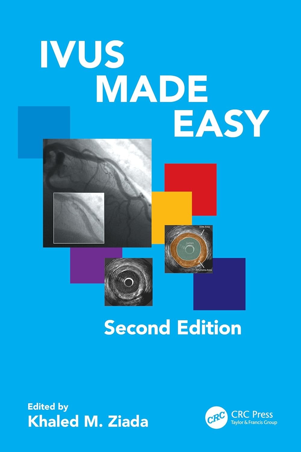 IVUS Made Easy,2nd Edition