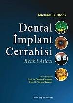 Dental İmplant Cerrahisi Renkli Atlası