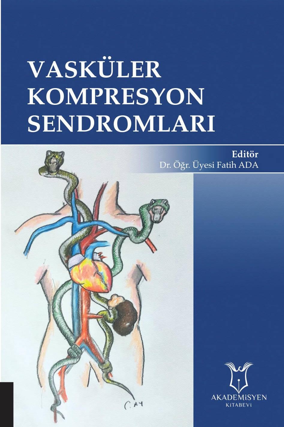 Vasküler Kompresyon Sendromları