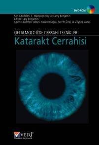 Oftalmoloji`de Cerrahi Teknikler Katarakt Cerrahisi