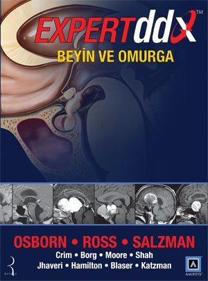 Osborn, Expert DDX  Beyin ve Omurga