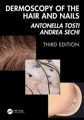 Dermoscopy of the Hair and Nails,3rd Edition