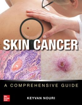 Skin Cancer: A Comprehensive Guide