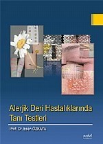 Alerjik Deri Hastalıklarında Tanı Testleri
