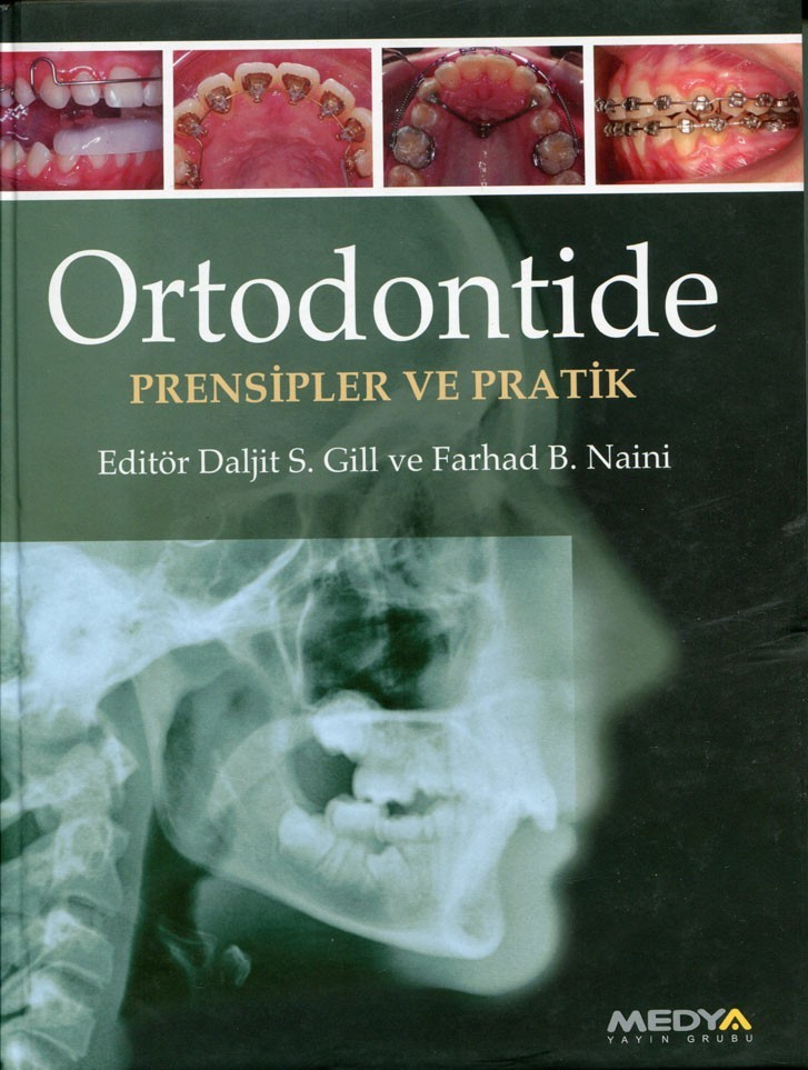 Ortodontide Prensipler ve Pratikler