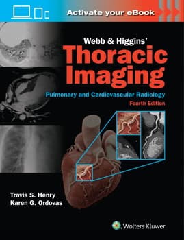 Webb & Higgins Thoracic Imaging: Print + eBook with Multimedia, 4th Edition