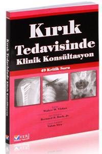 Kırık Tedavisinde Klinik Konsültasyon 49 Kritik Soru