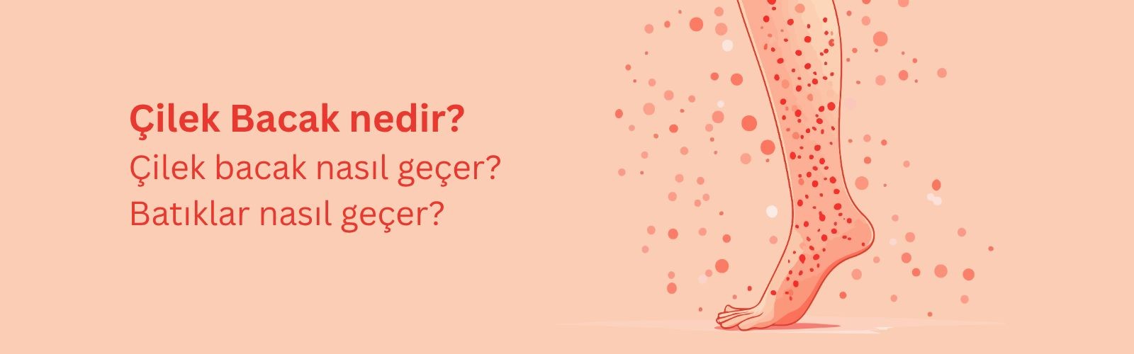 Çilek Bacak Nedir ve Nasıl Geçer? Batıklar Nasıl Geçer?