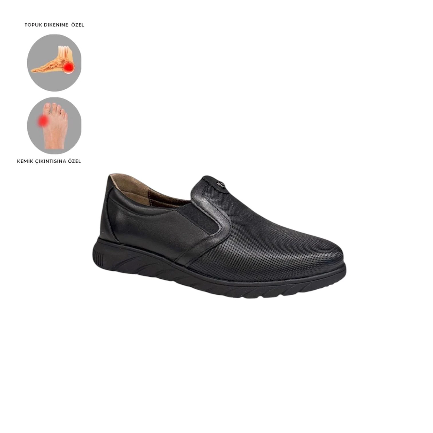 Mira Ortopedik Kadın Deri Ayakkabı Topuk Dikeni Kemik Çıkıntısı Taraklı Ayaklar İçin Uygundur