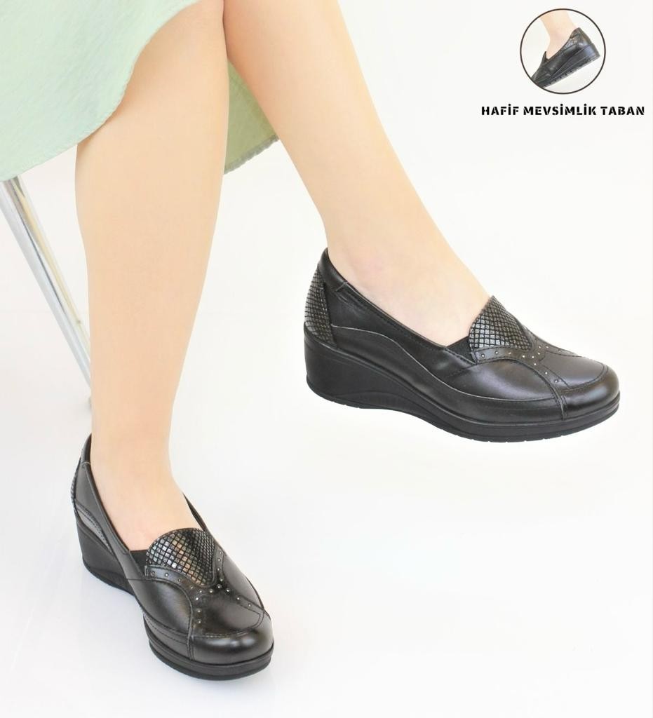 Mira Ortopedik Kadın Deri Ayakkabı Topuk Dikeni Kemik Çıkıntısı Ayaklar İçin Uygundur