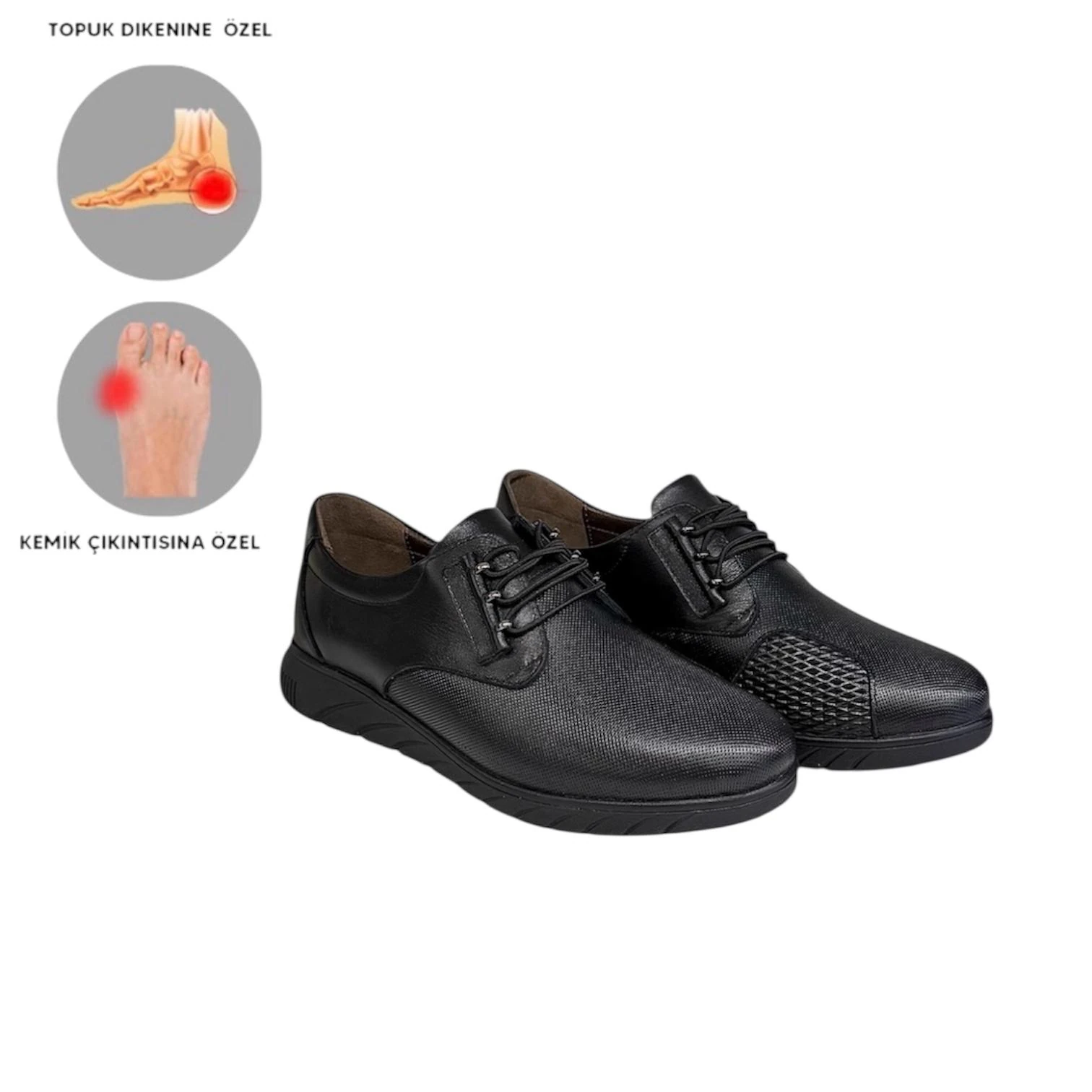 Mira Ortopedik Kadın Deri Ayakkabı Topuk Dikeni Kemik Çıkıntısı Taraklı Ayaklar İçin Uygundur