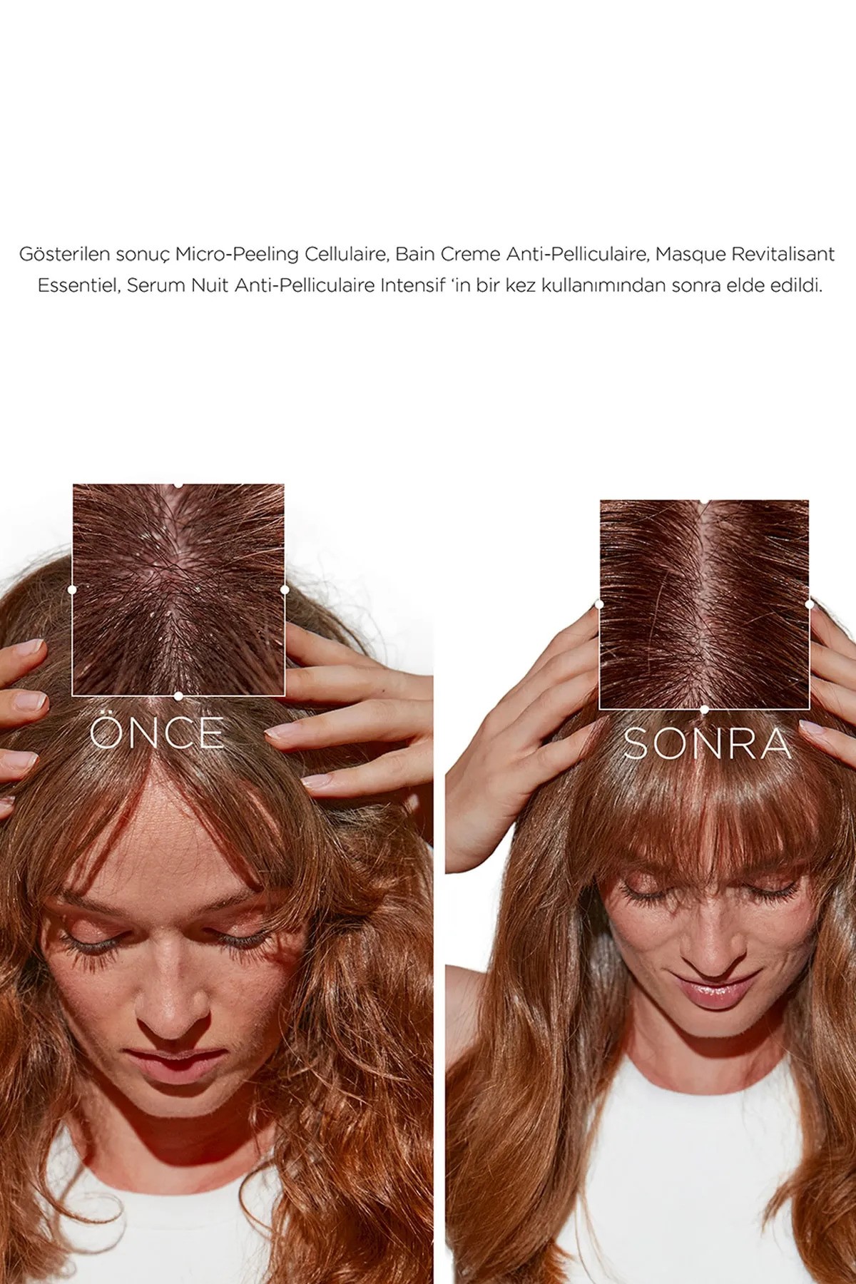 Kerastase Symbiose  Hassas Saç Derisi ve Kepeğe Eğilimli Saçlar İçin Saç Bakım Kremi 200 ml