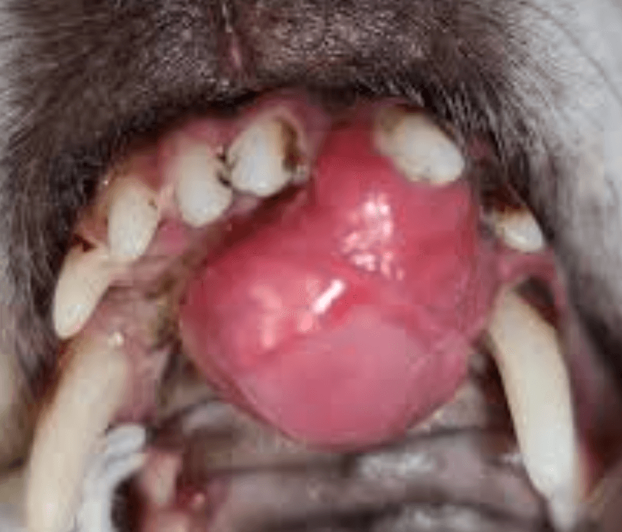 Oral Melanom Nasıl Teşhis Edilir?