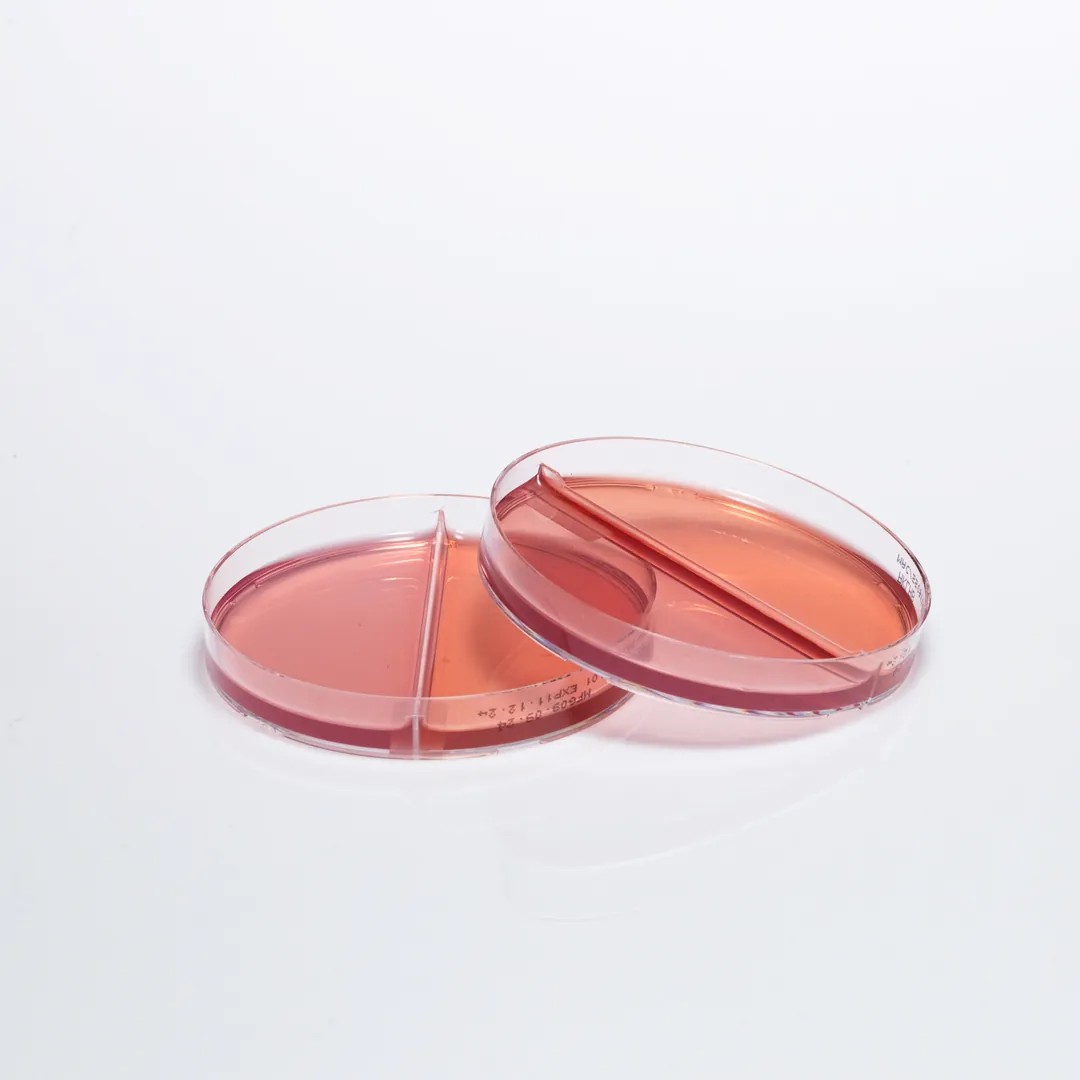 SS AGAR + MACCONKEY AGAR