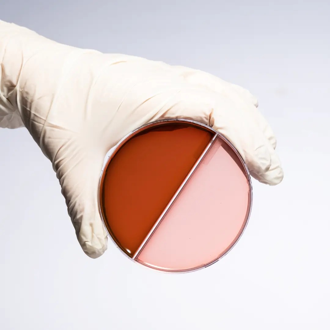 SS AGAR + EMB AGAR