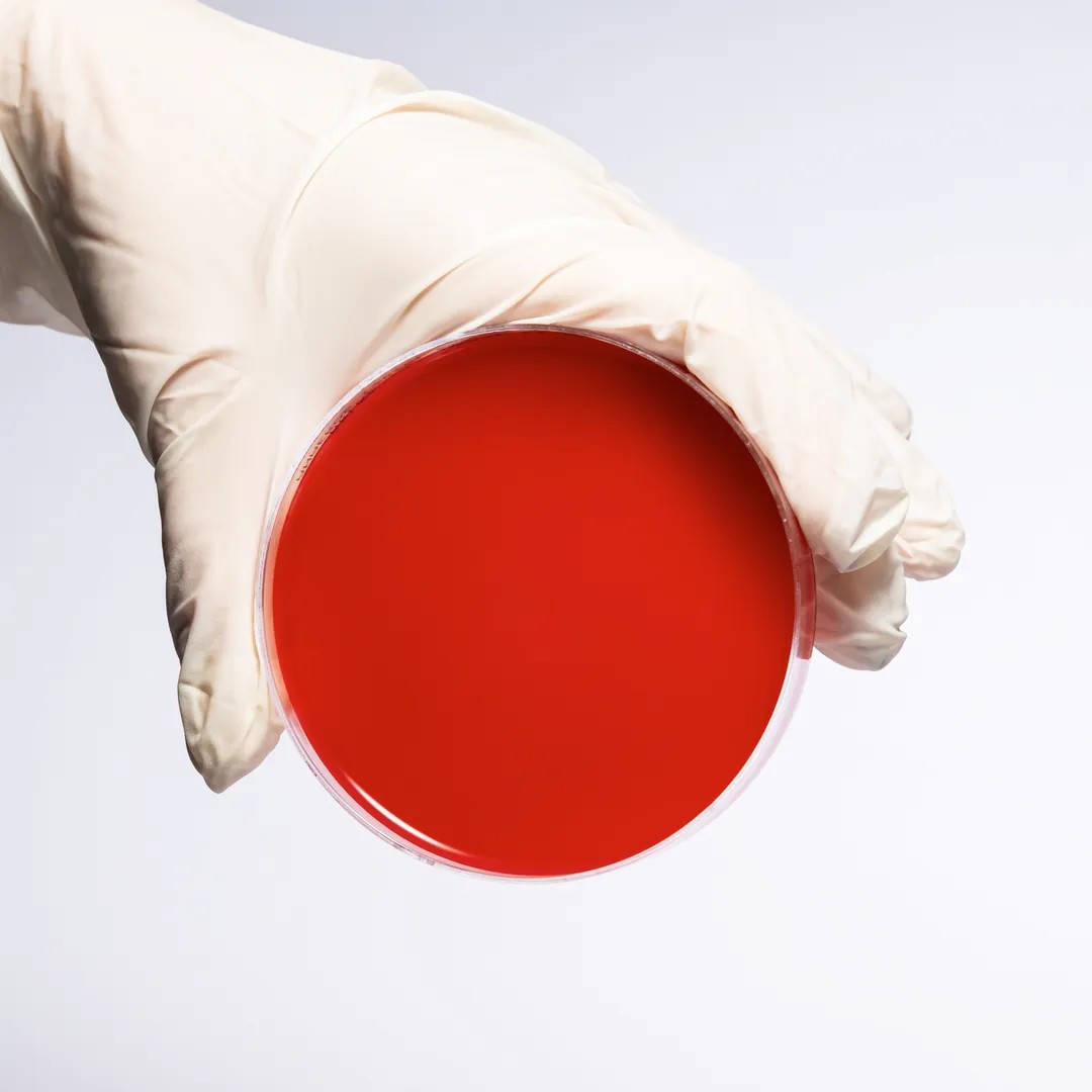ANAEROBIC CULTURE MEDIUM AGAR