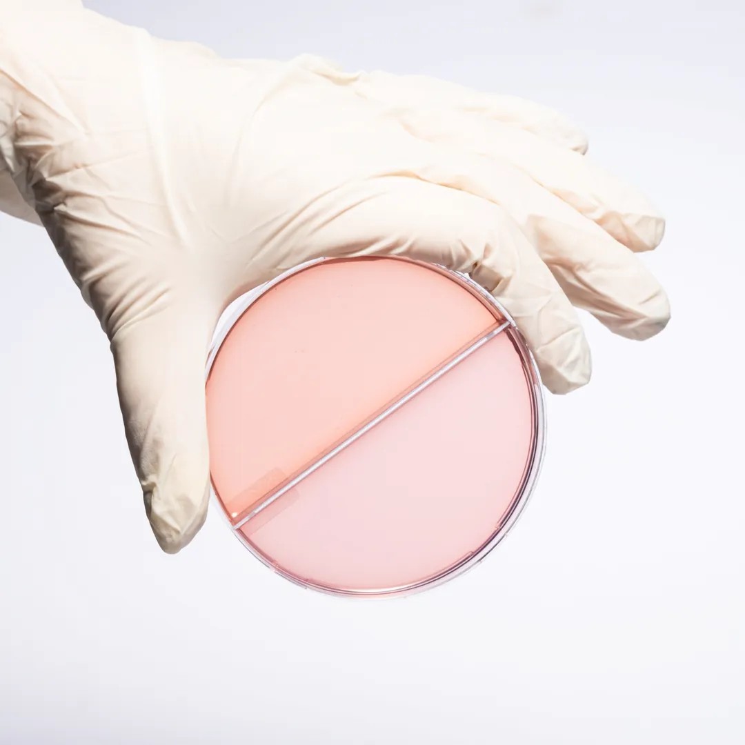 SS AGAR + MACCONKEY AGAR