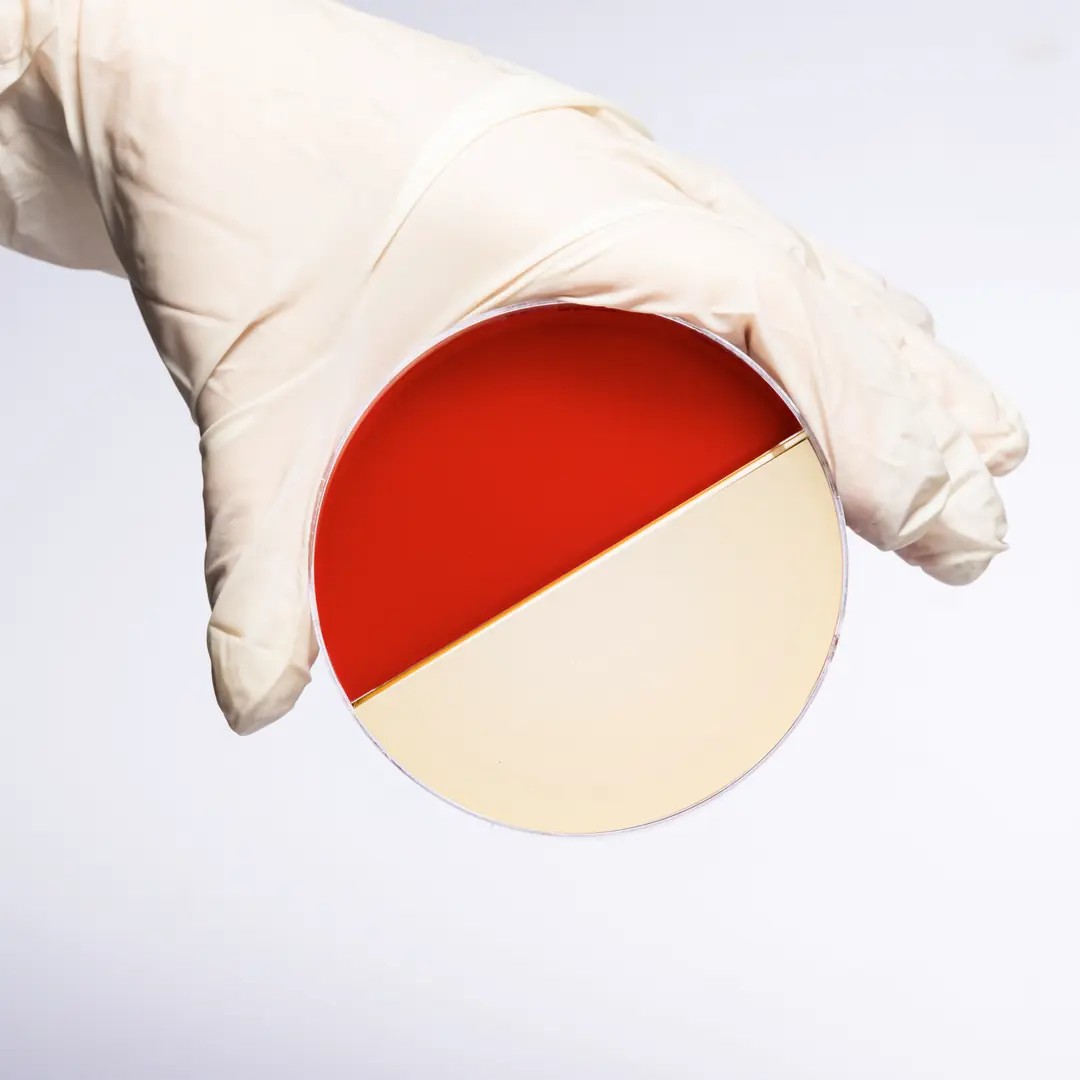 BLOOD AGAR + CHROMOGENIC UTI AGAR