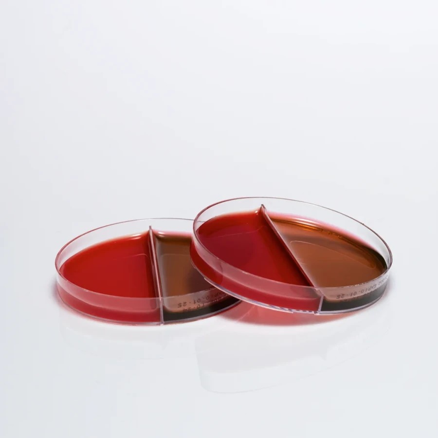PREPARED SHEEP BLOOD AGAR AND CHOCOLATE AGAR