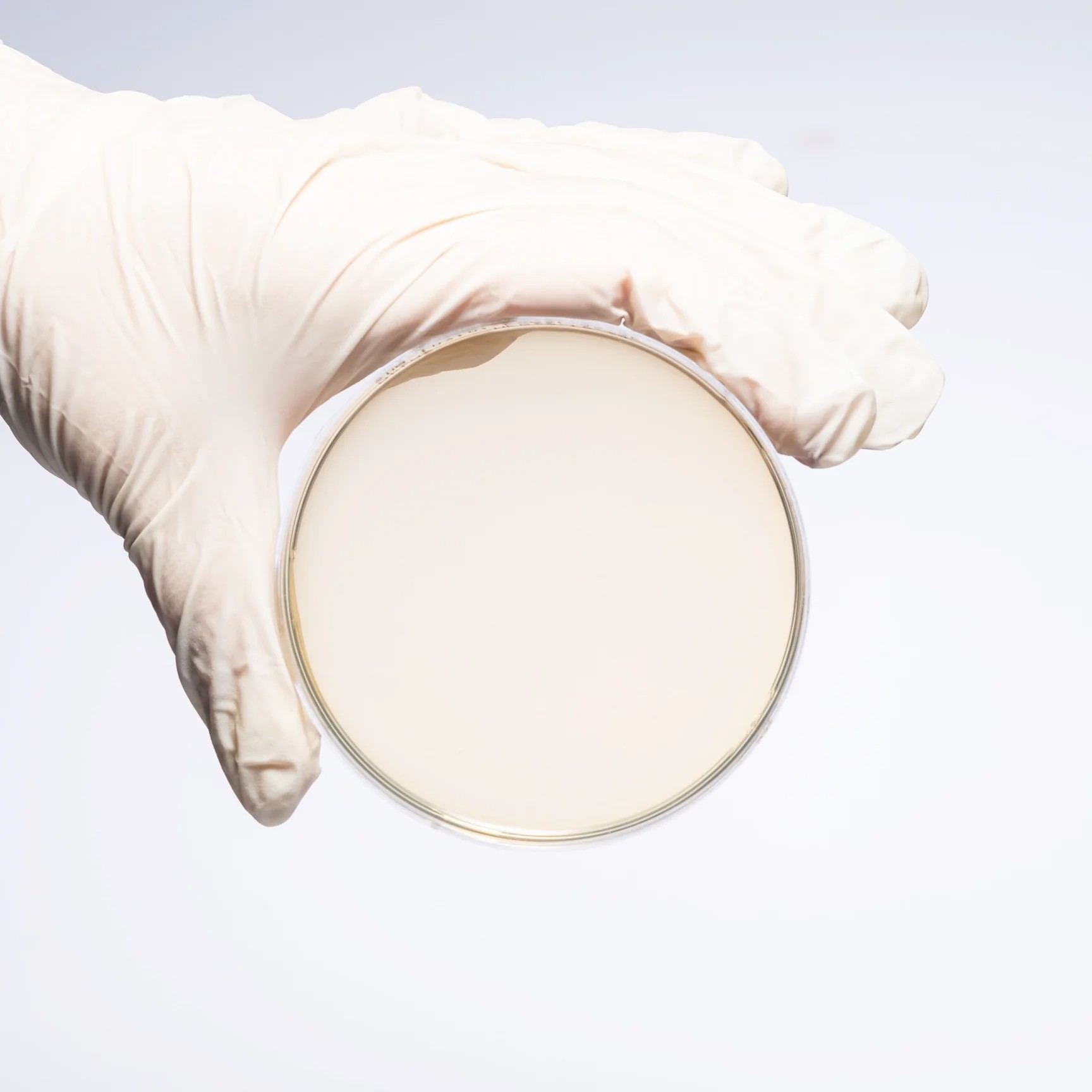 SABOURAUD DEXTROSE AGAR (SDA)
