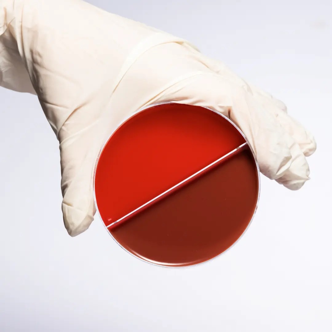 BLOOD AGAR + CHOCOLATE AGAR