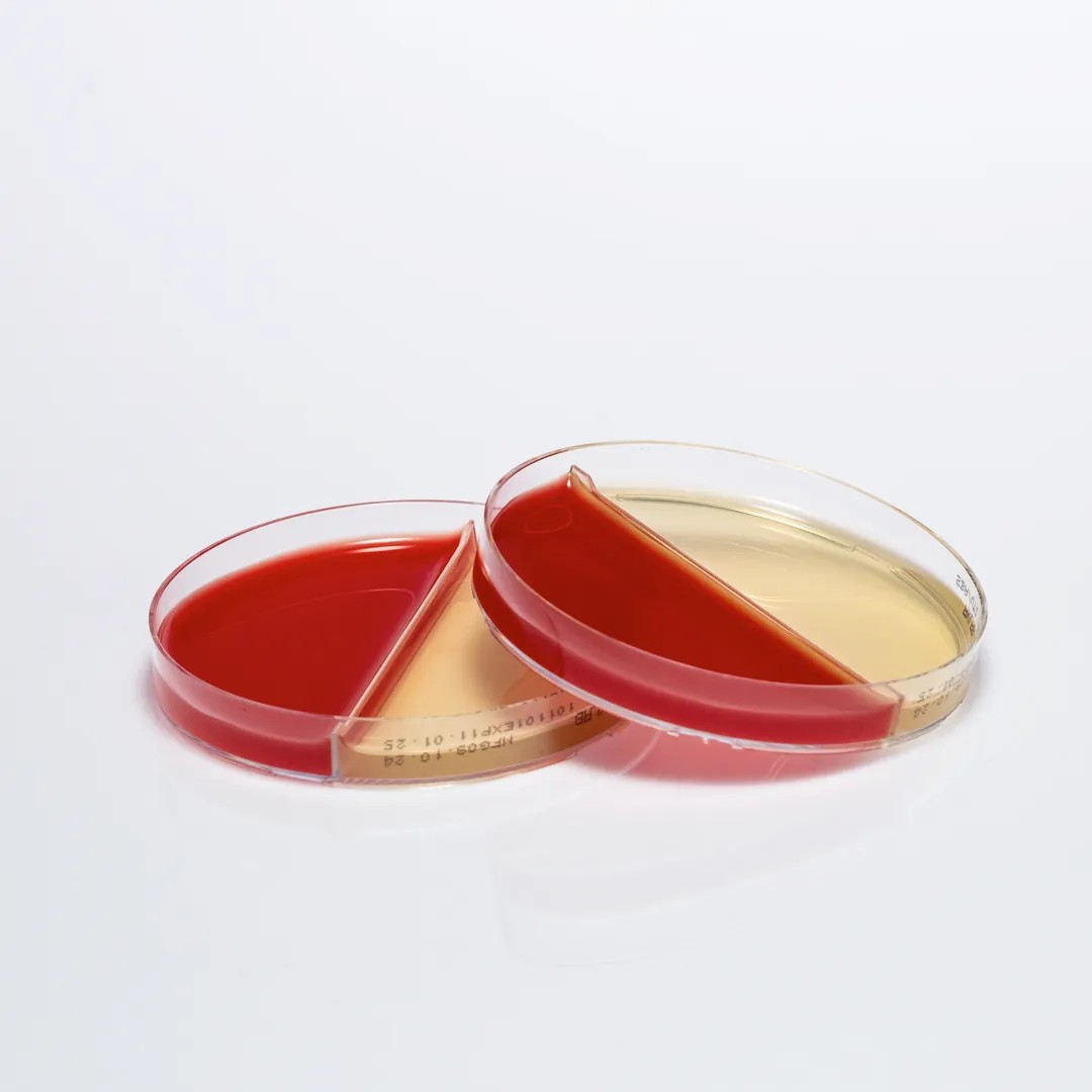 BLOOD AGAR + CHROMOGENIC UTI AGAR