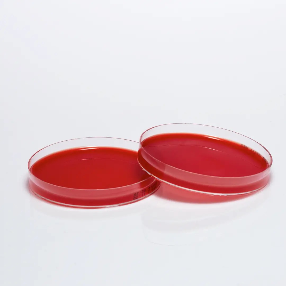 SHEEP BLOOD AGAR