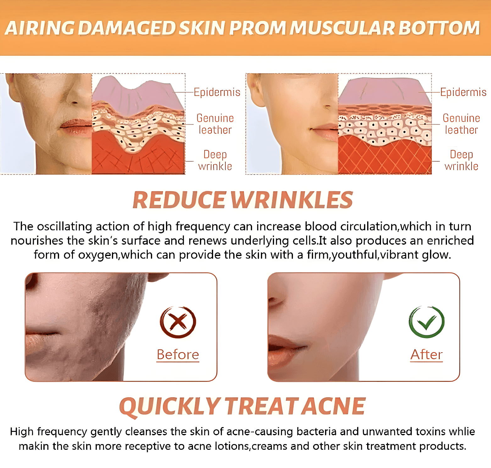 Defond-High Frequency Skin Care Device High Frequency