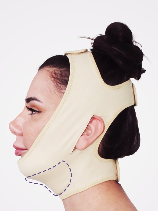 LP-106 POST-SURGICAL FACIAL-CHIN-NECK BANDAGE WITH PAD