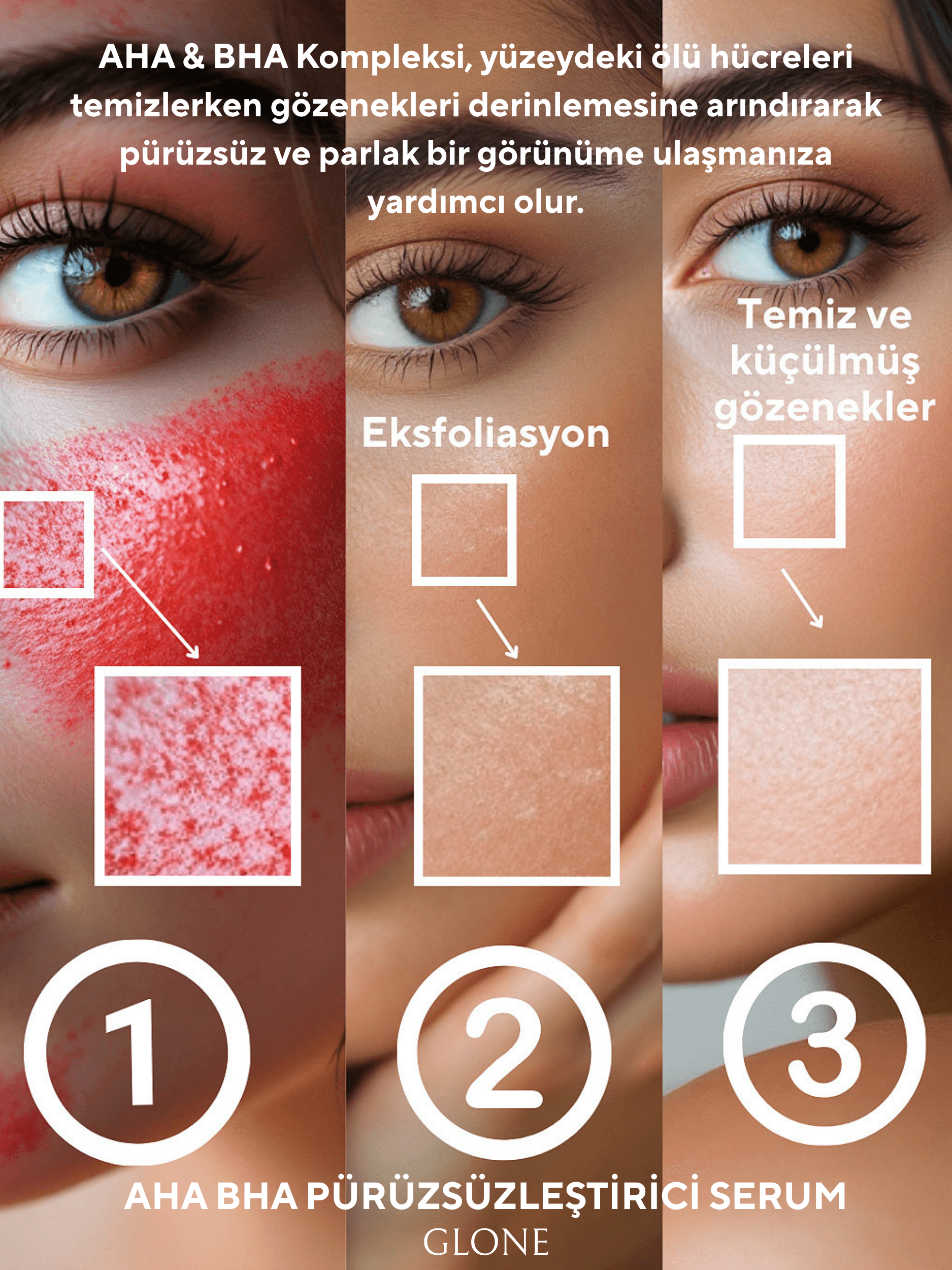 GLONE AHA BHA Pürüzsüzleştirici Serum 30ml | Hyaluronik Asit, Glycolic Acid & Centella Asiatica İçeren Peeling Serum | Cilt Yenileme ve Parlaklık