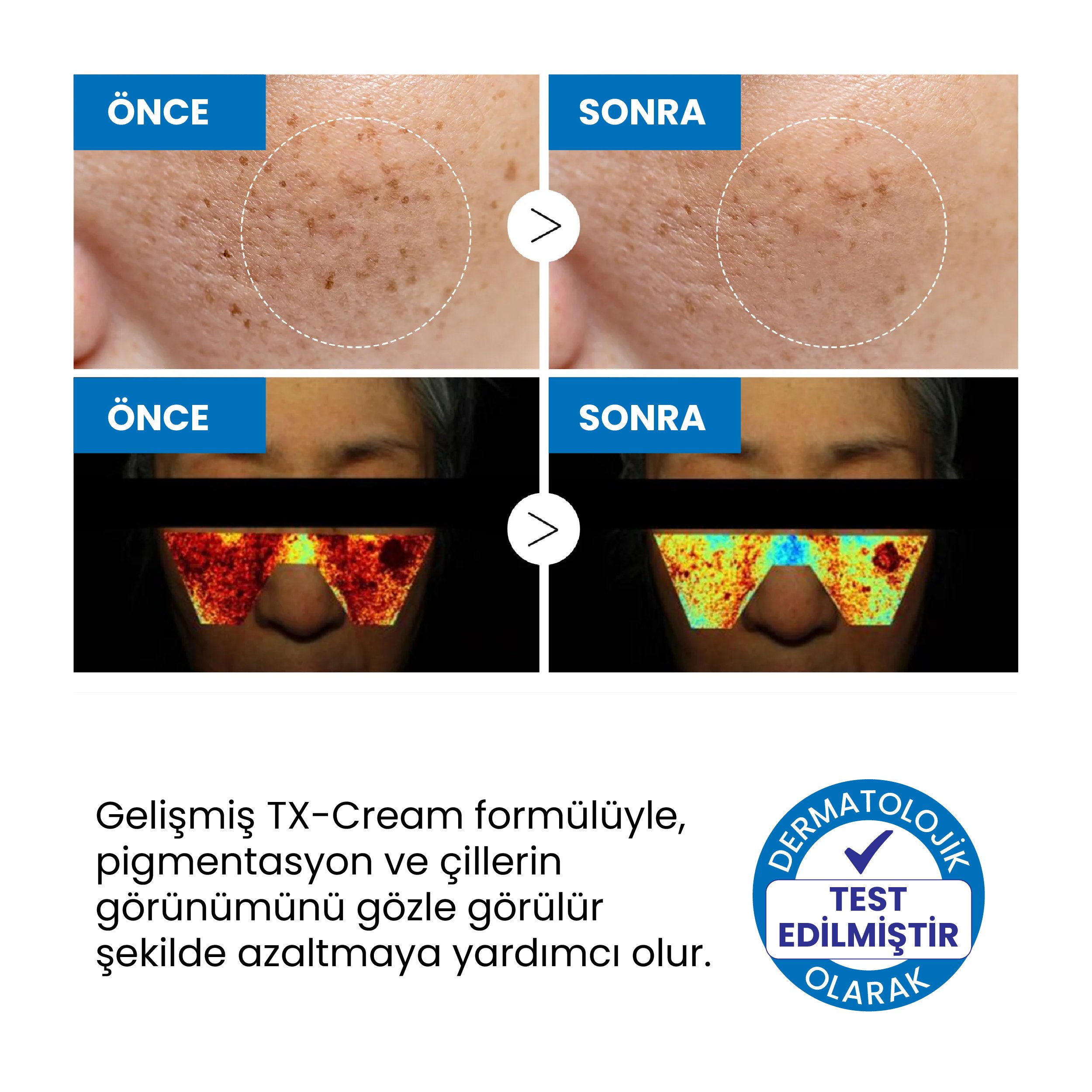 TX Koyu Leke Karşıtı Aydınlatıcı Yüz Bakım Kremi 50ml