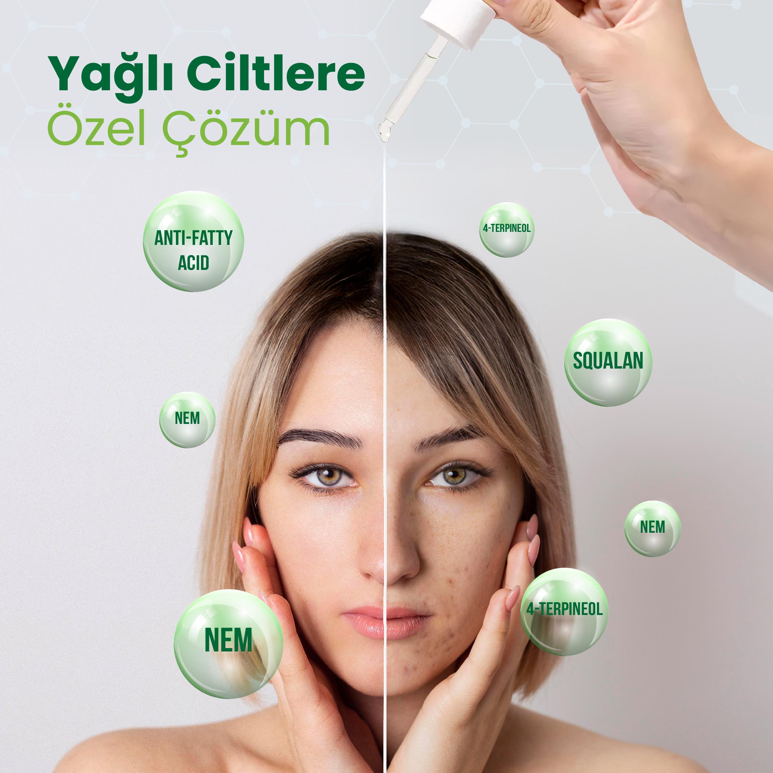 Lipino Sivilce Ve Yağlanma Karşıtı Ampul 30ml