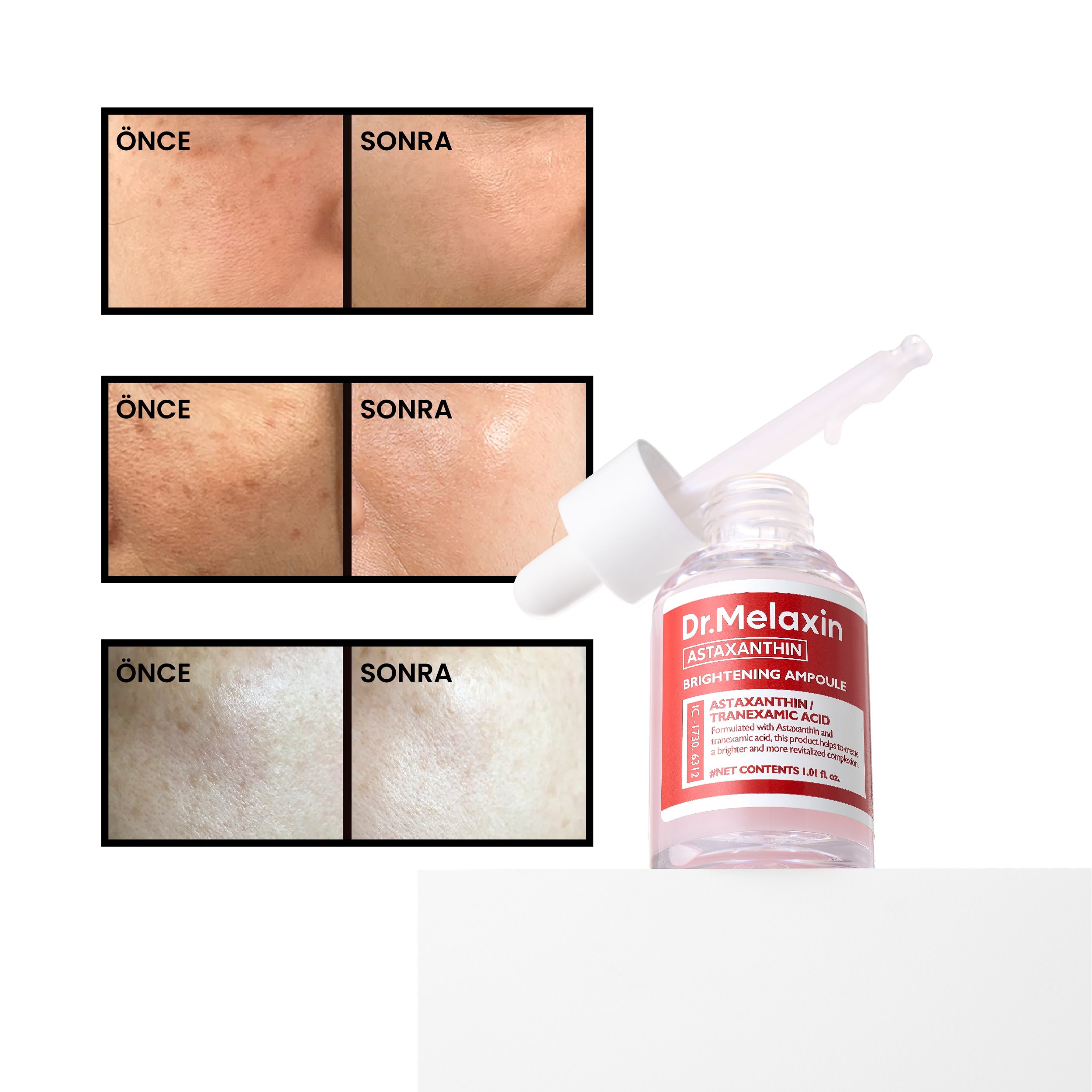 Astaxanthin Leke Karşıtı Aydınlatıcı Ampül