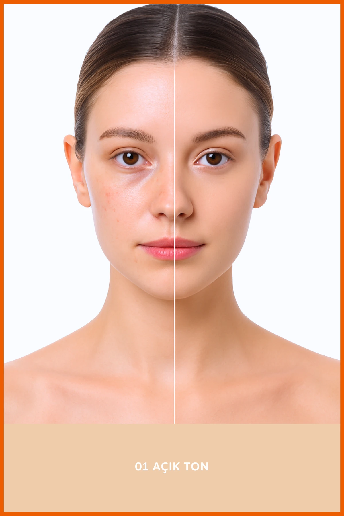 Soltis Nemlendirici ve Leke Karşıtı BB Krem SPF50+ Pa++++