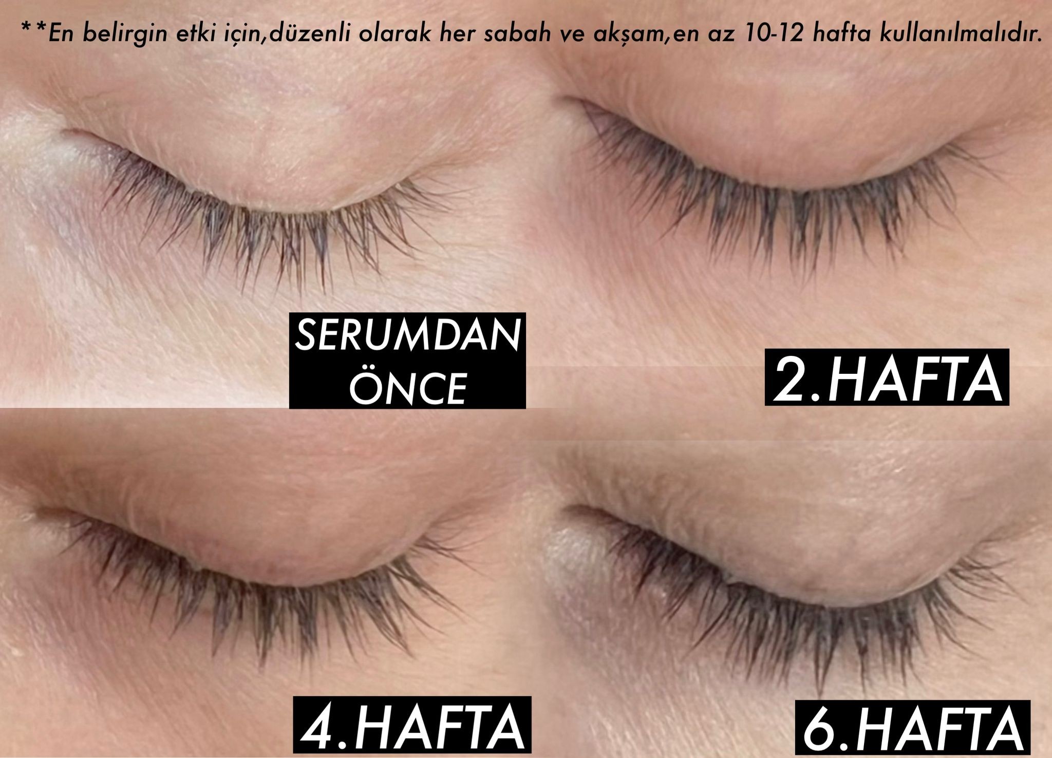 Uzatan, Çoğaltan Ve Güçlendiren Kaş Kirpik Bakım Serumu 4.5ml