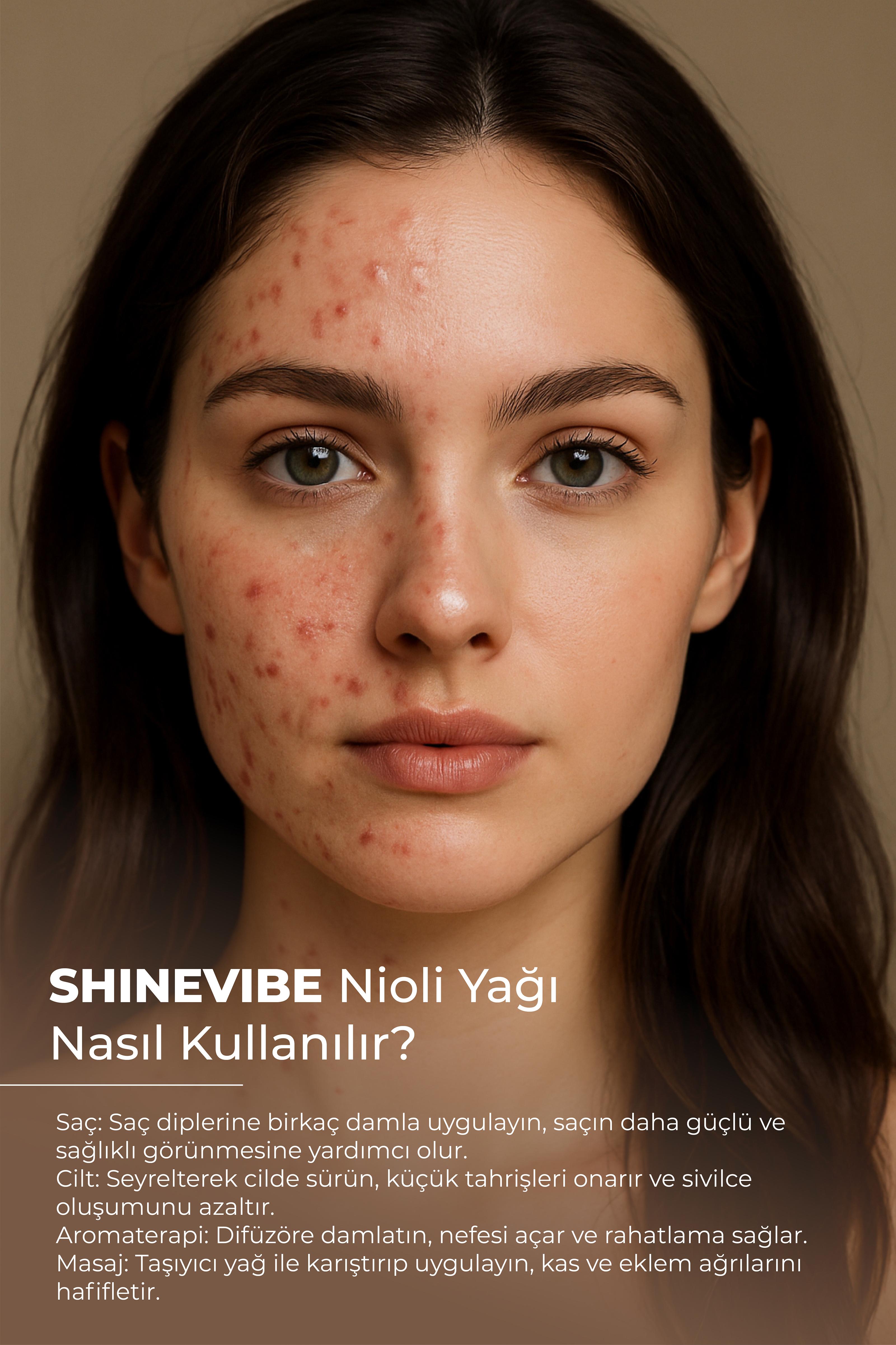 Nioli Yağı 20 ml