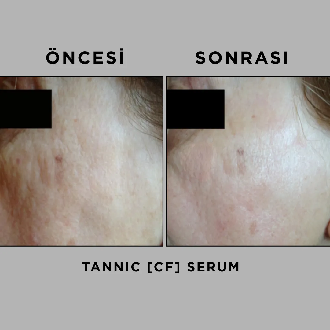 TANNIC [CF] SERUM 30 ml