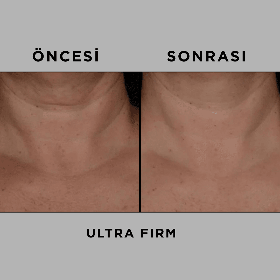 ULTRA FIRM 50 ml
