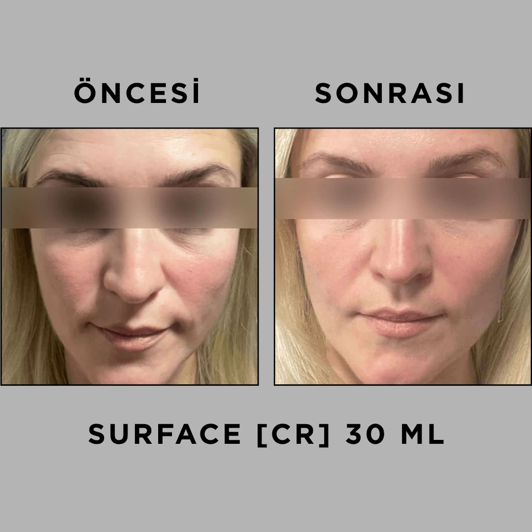SURFACE [CR] 30 ML