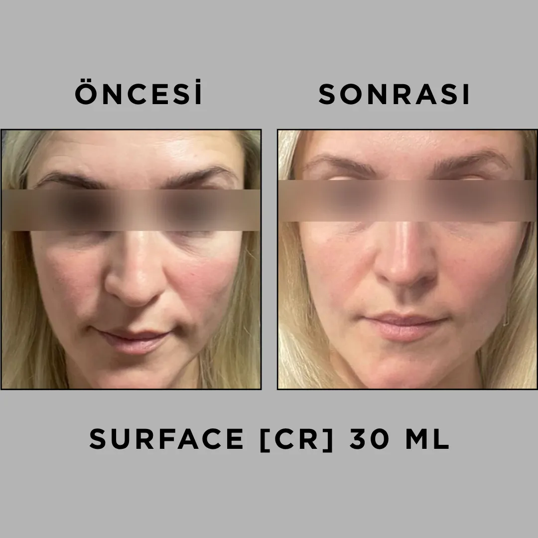 SURFACE [CR] 30 ML