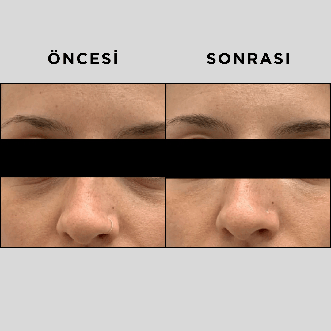 EYE MATRIX